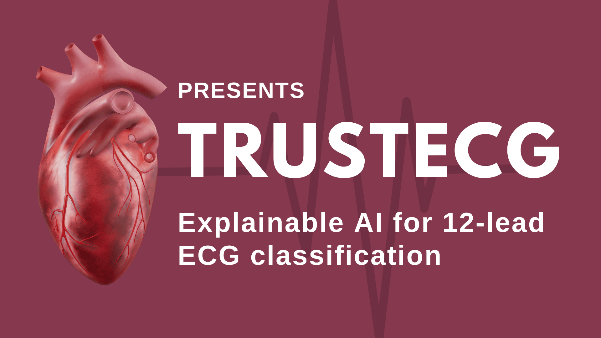 TrustECG